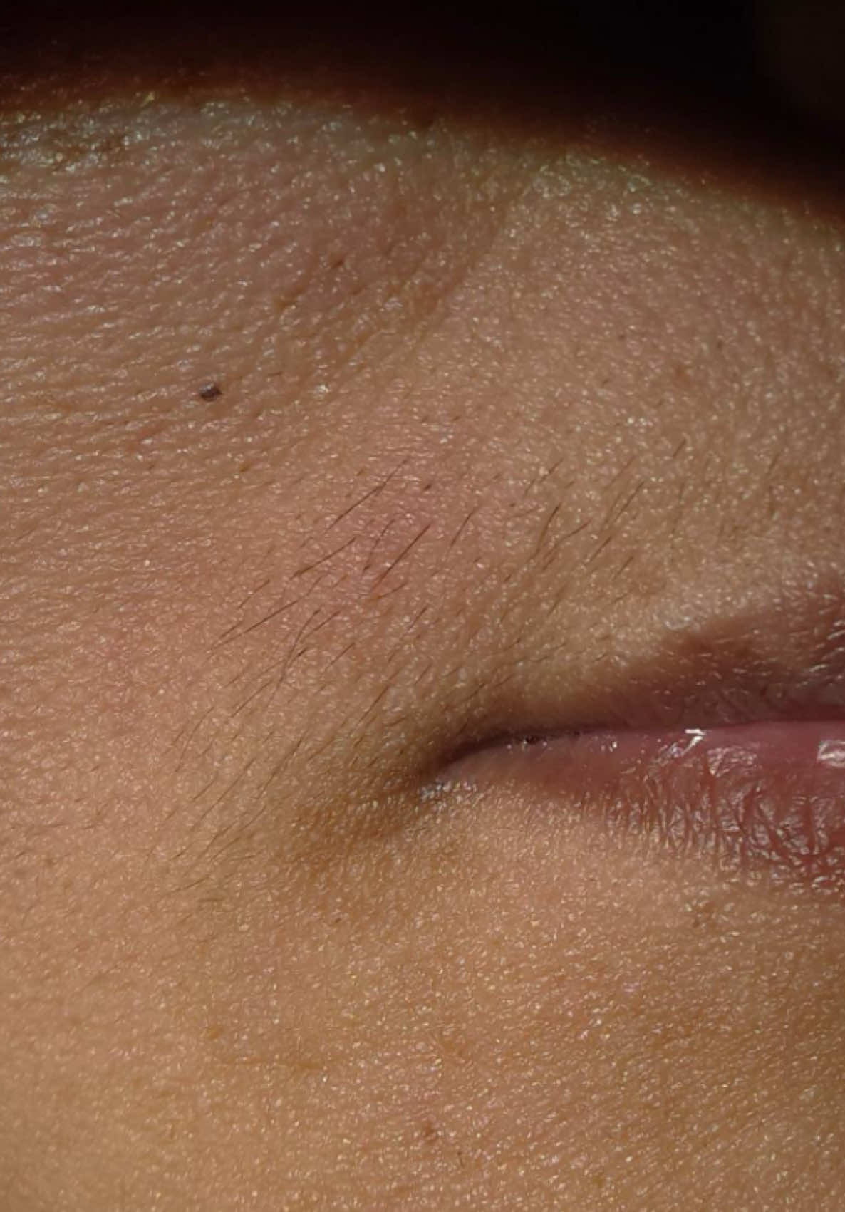 @Neurospice Beauty Electrolysis