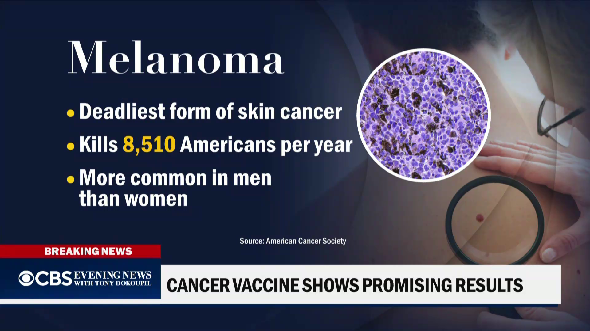 @CBSEveningNews