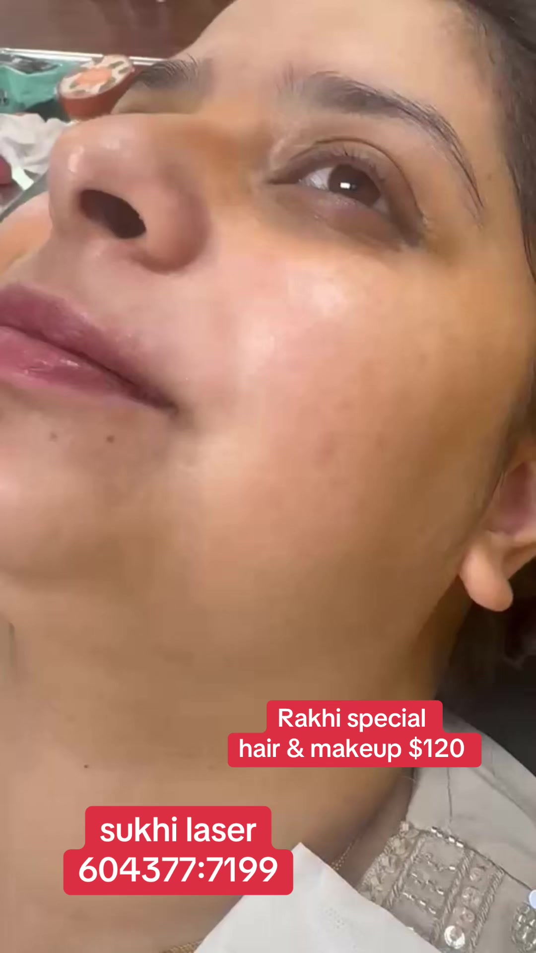 @Sukhi Laser Beauty Academy LTD