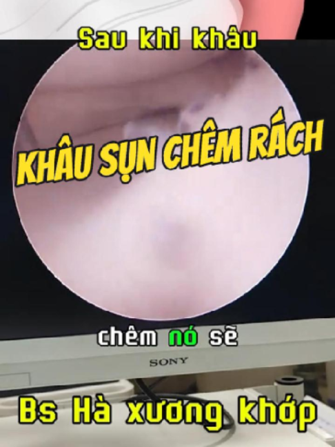 @Chuyên gia xương khớp