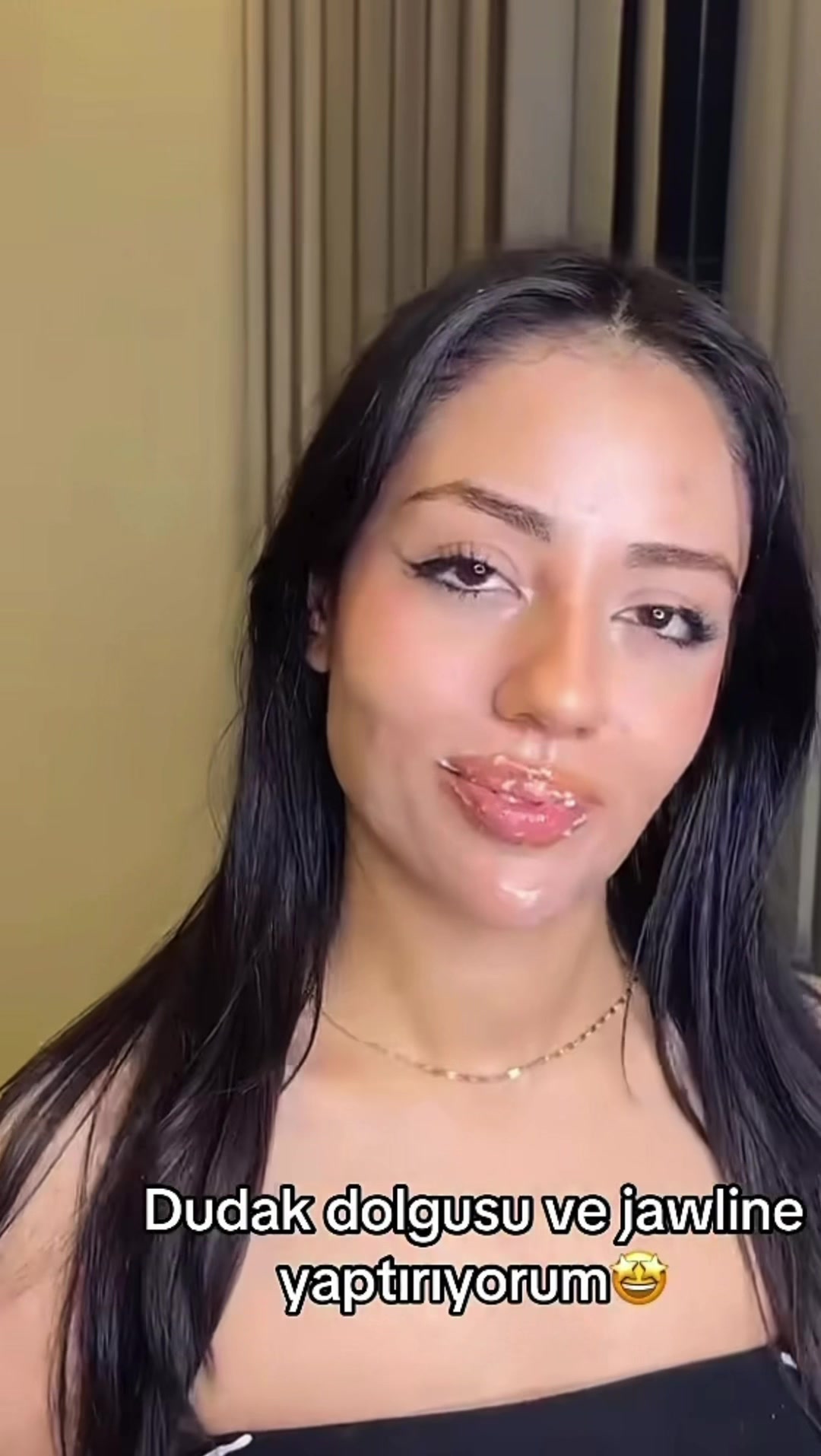 @🧚&zwj;♀️esmersekersl🧚&zwj;♀️