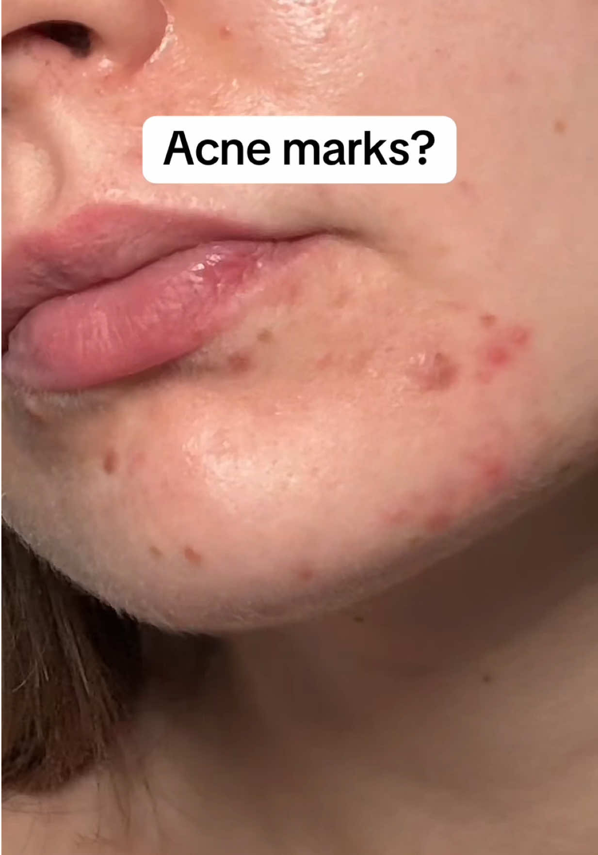 @watermelonsugarskin