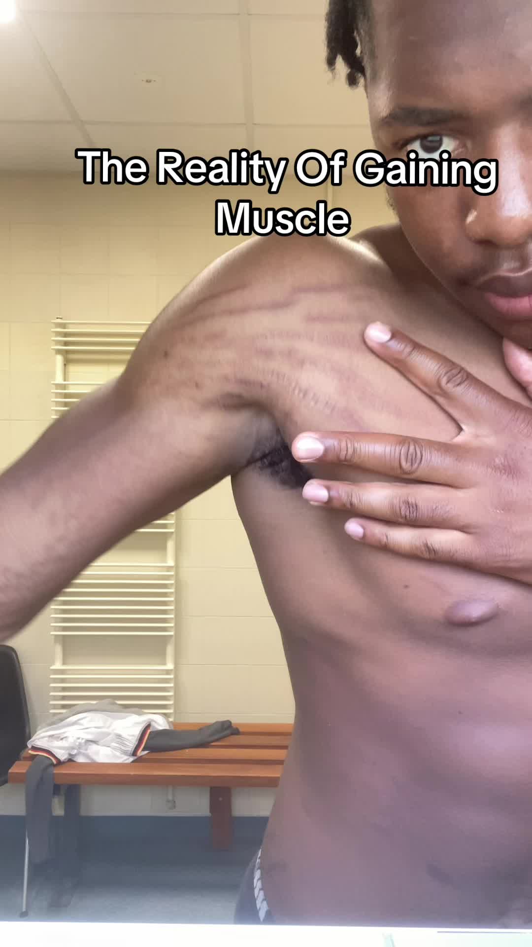 @Stretch marks guy