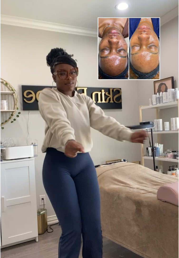 @Zee | Frisco Texas Esthetician