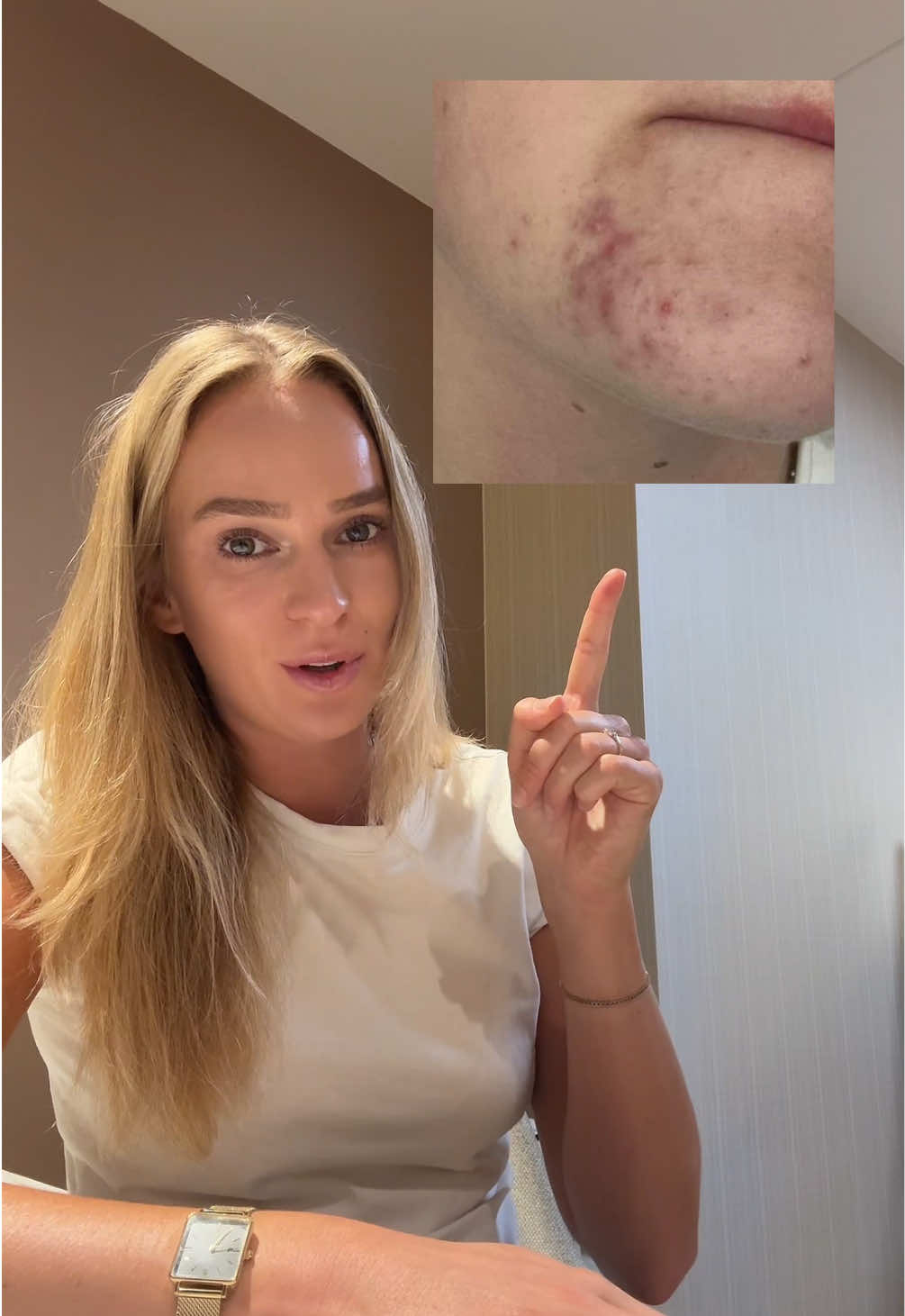@Skinfixer