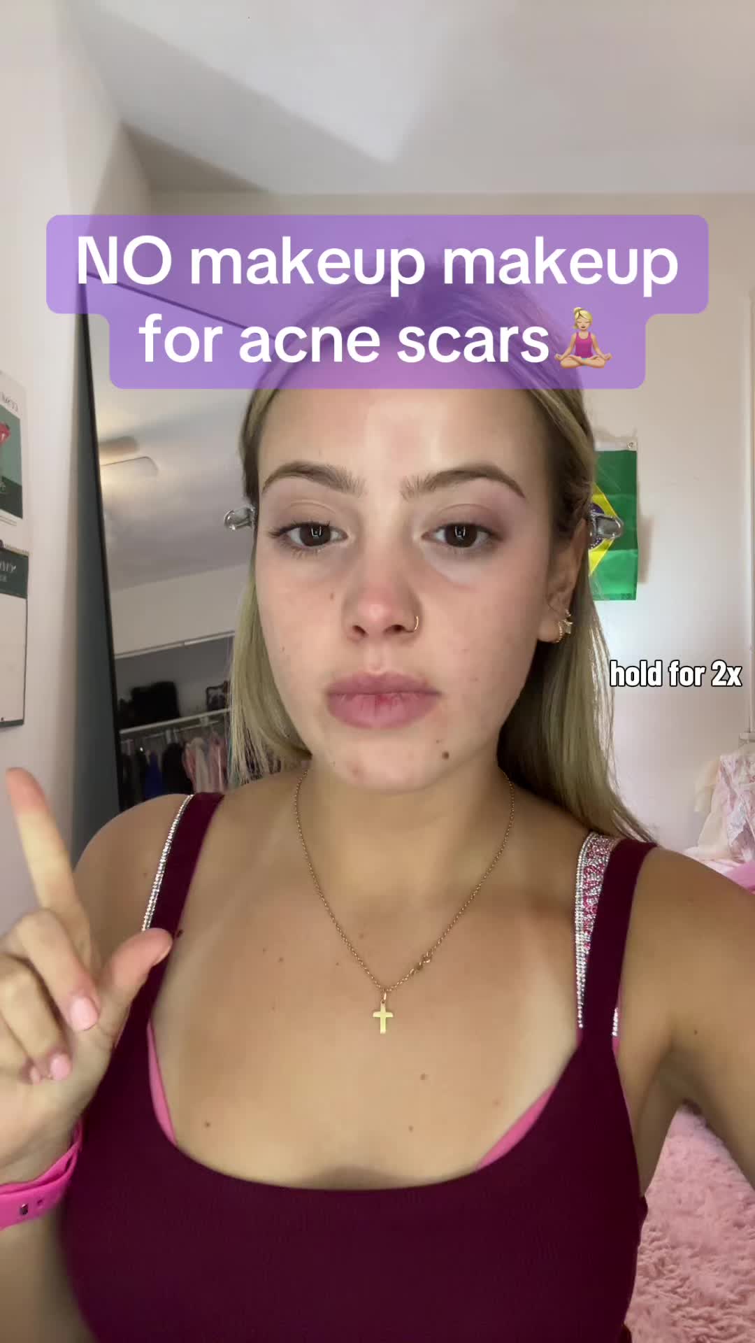 @cheeto🙈