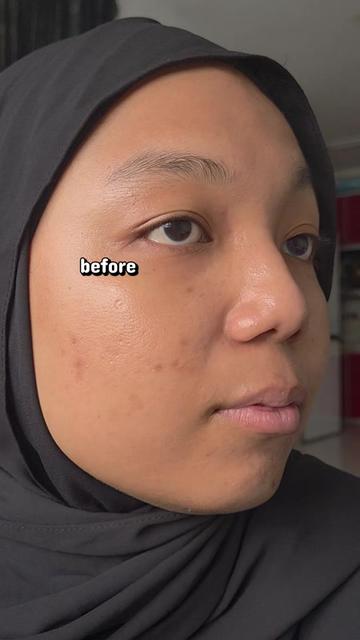 @Ezahty Rosli