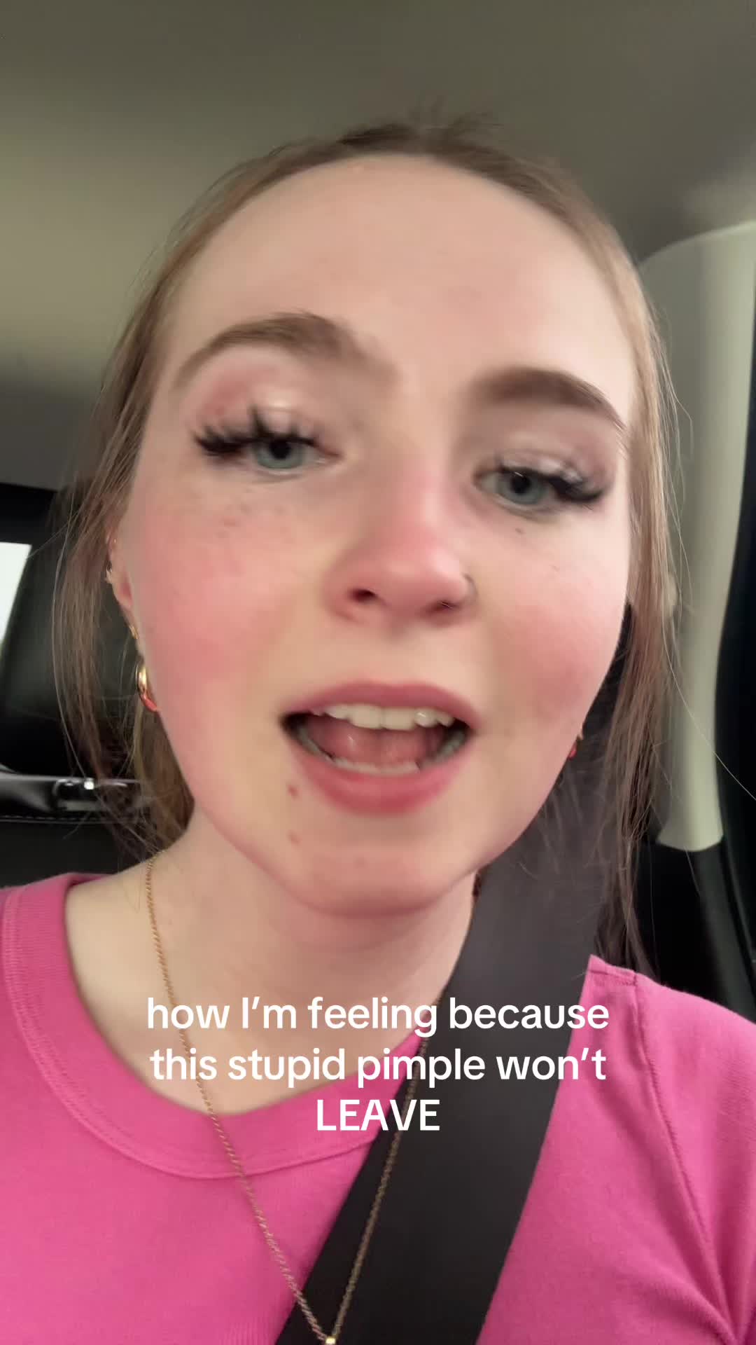 @carly🦨