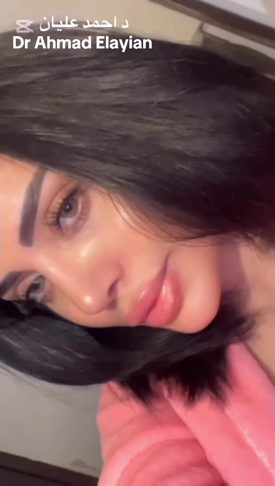 @Dr Ahmad Elayian
