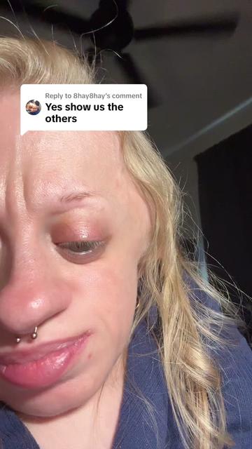 @Abby♿️