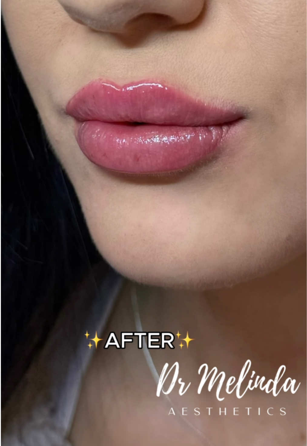 @Dr Melinda Aesthetics