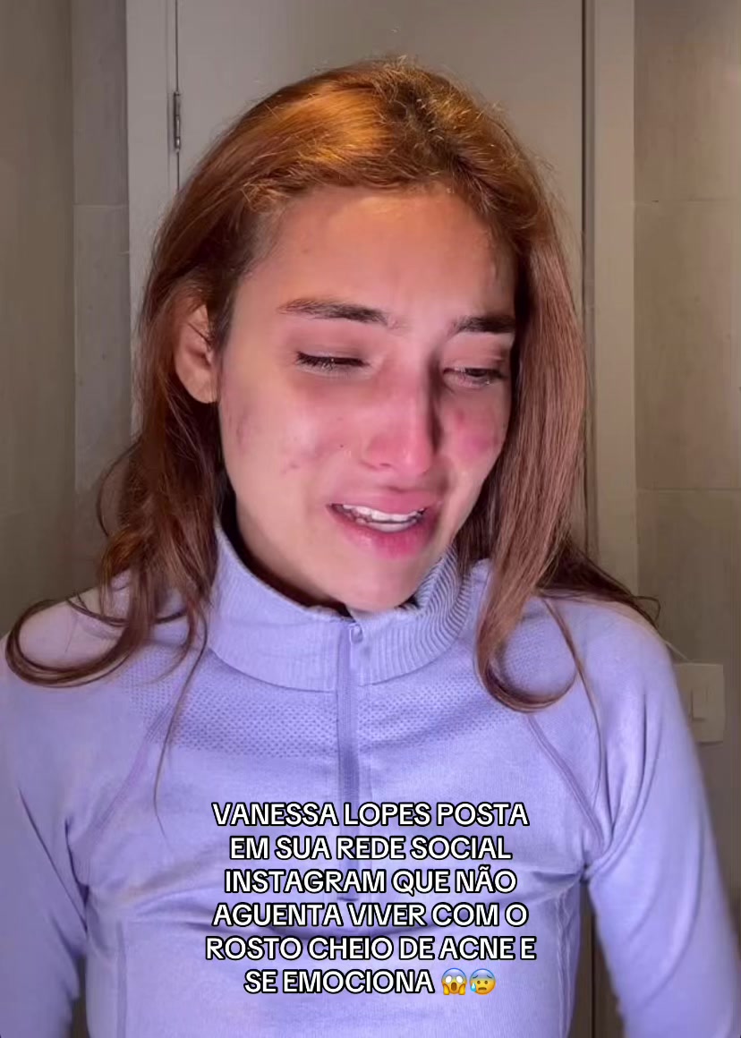 @Japa