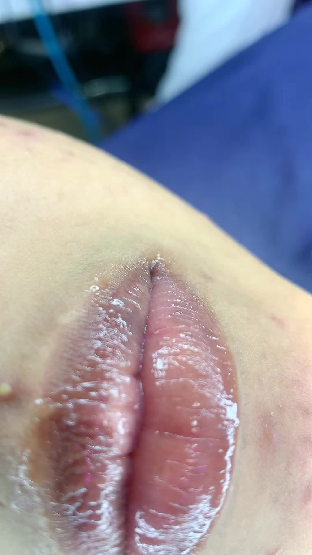 @Dr.Naasir🦷🩵🩺