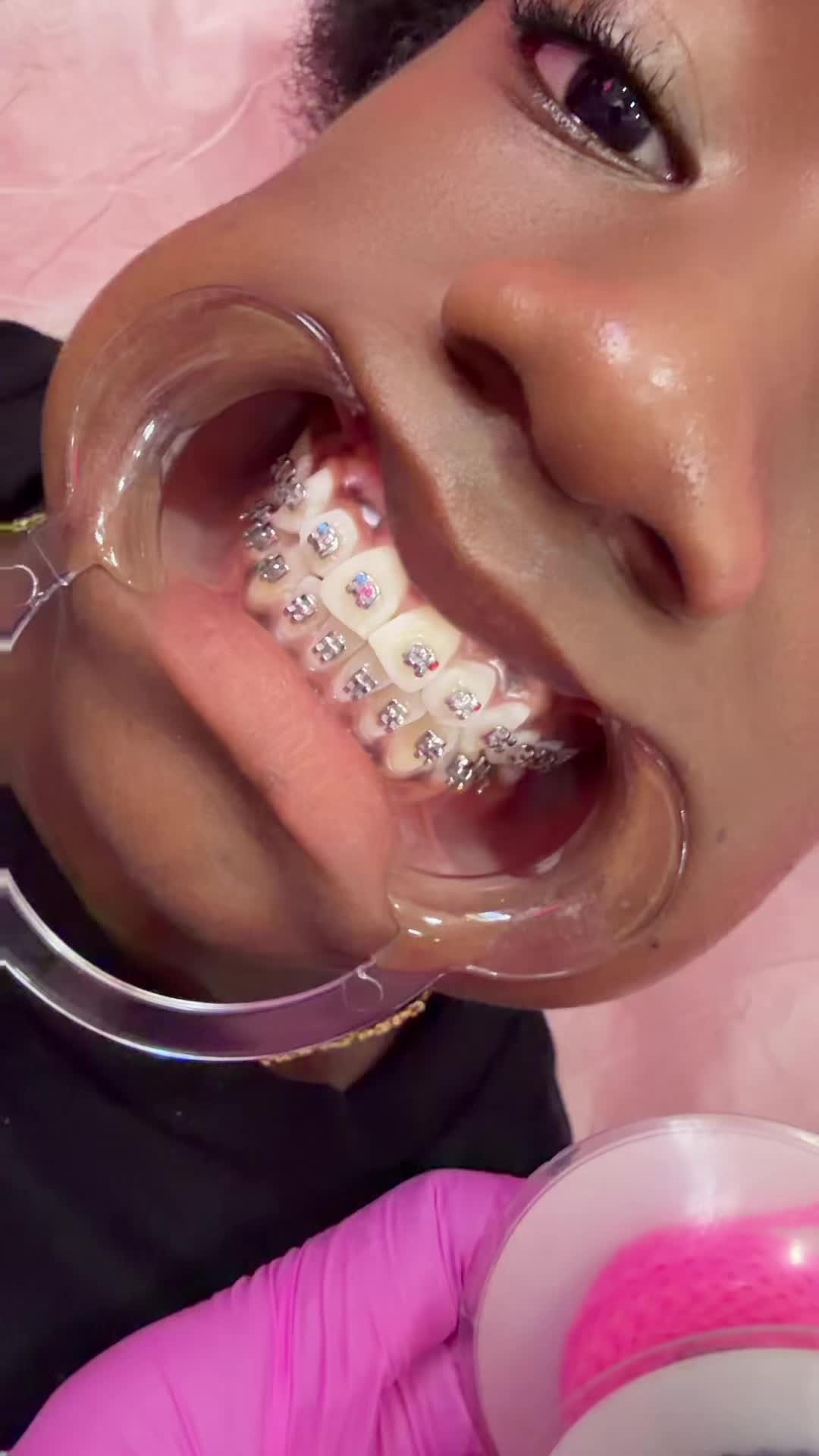 @Livii