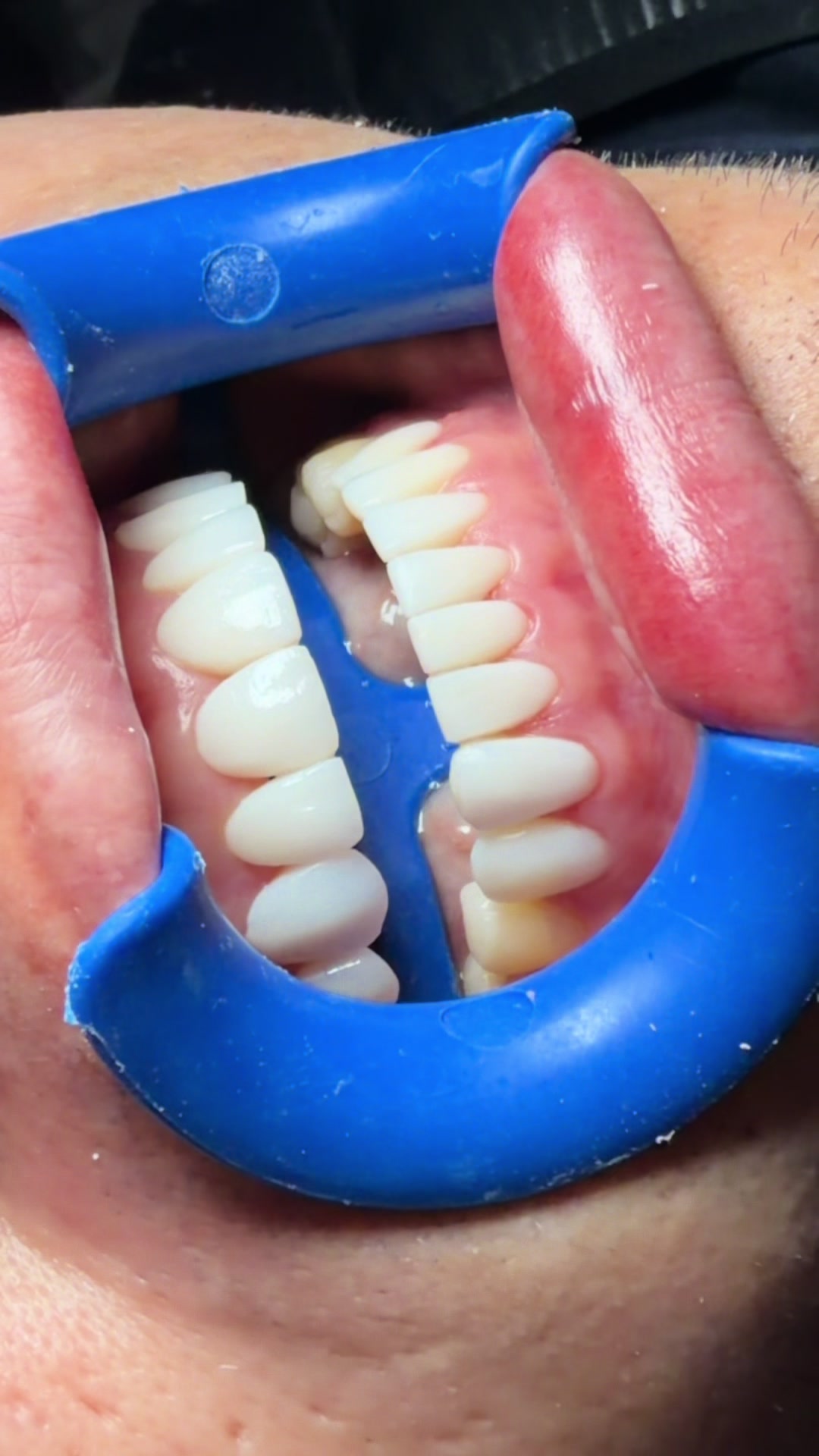 @Smiledent