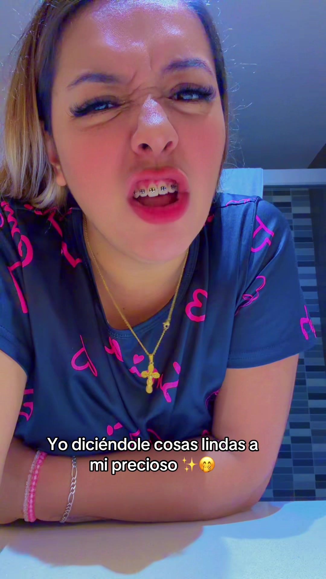 @Ani lindis