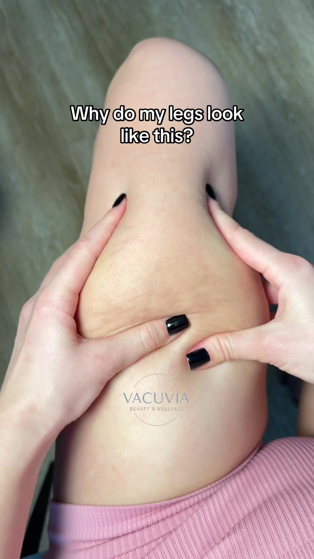 @vacuviaa