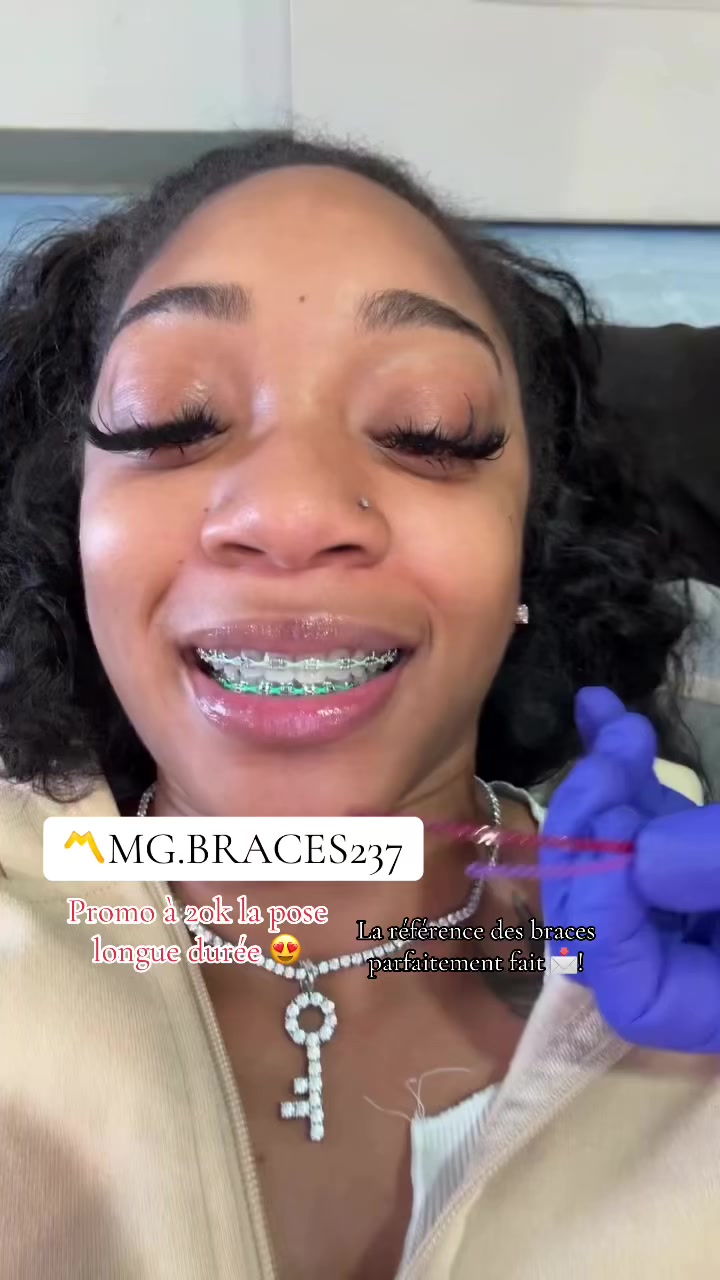 @MG BRACES