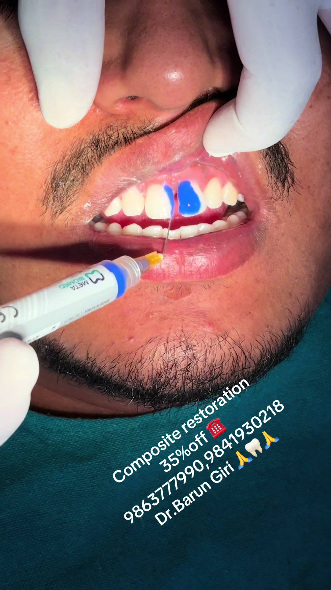 @Unique dental clinic Chabahil