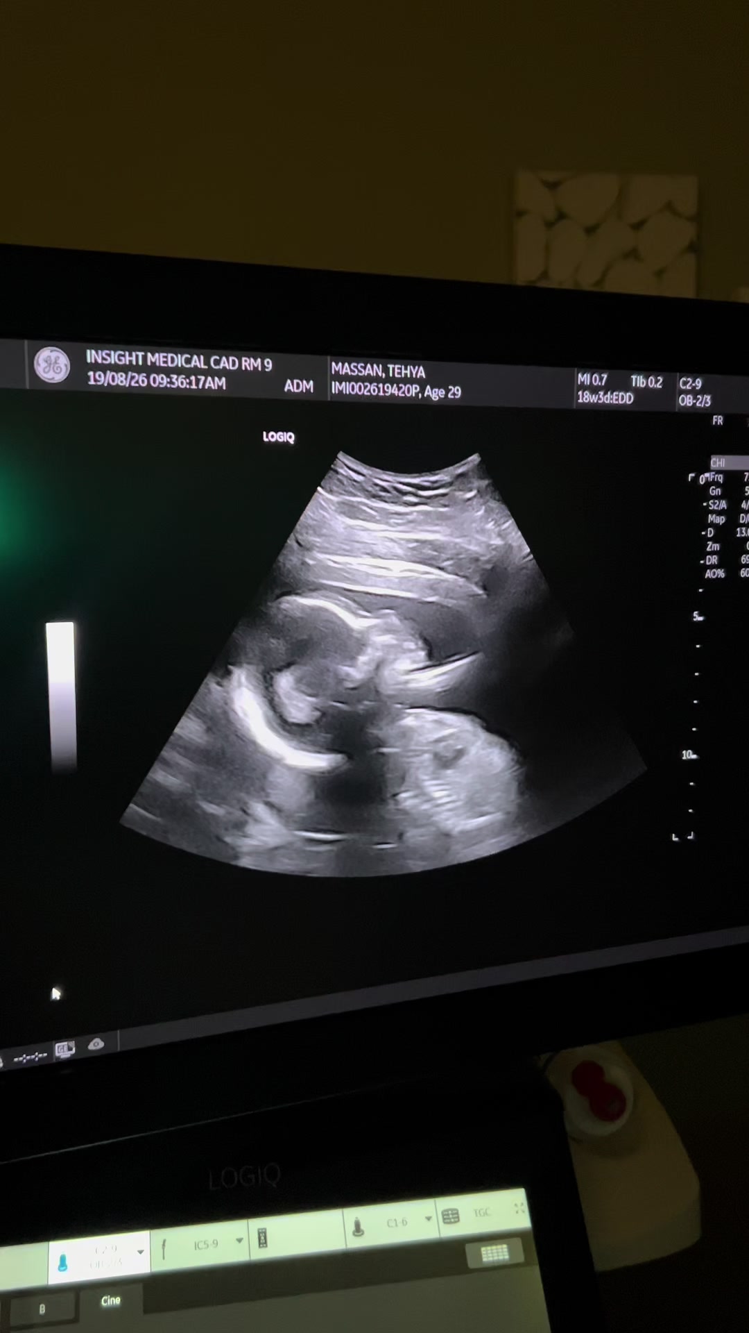 @🧿mistatim🧿