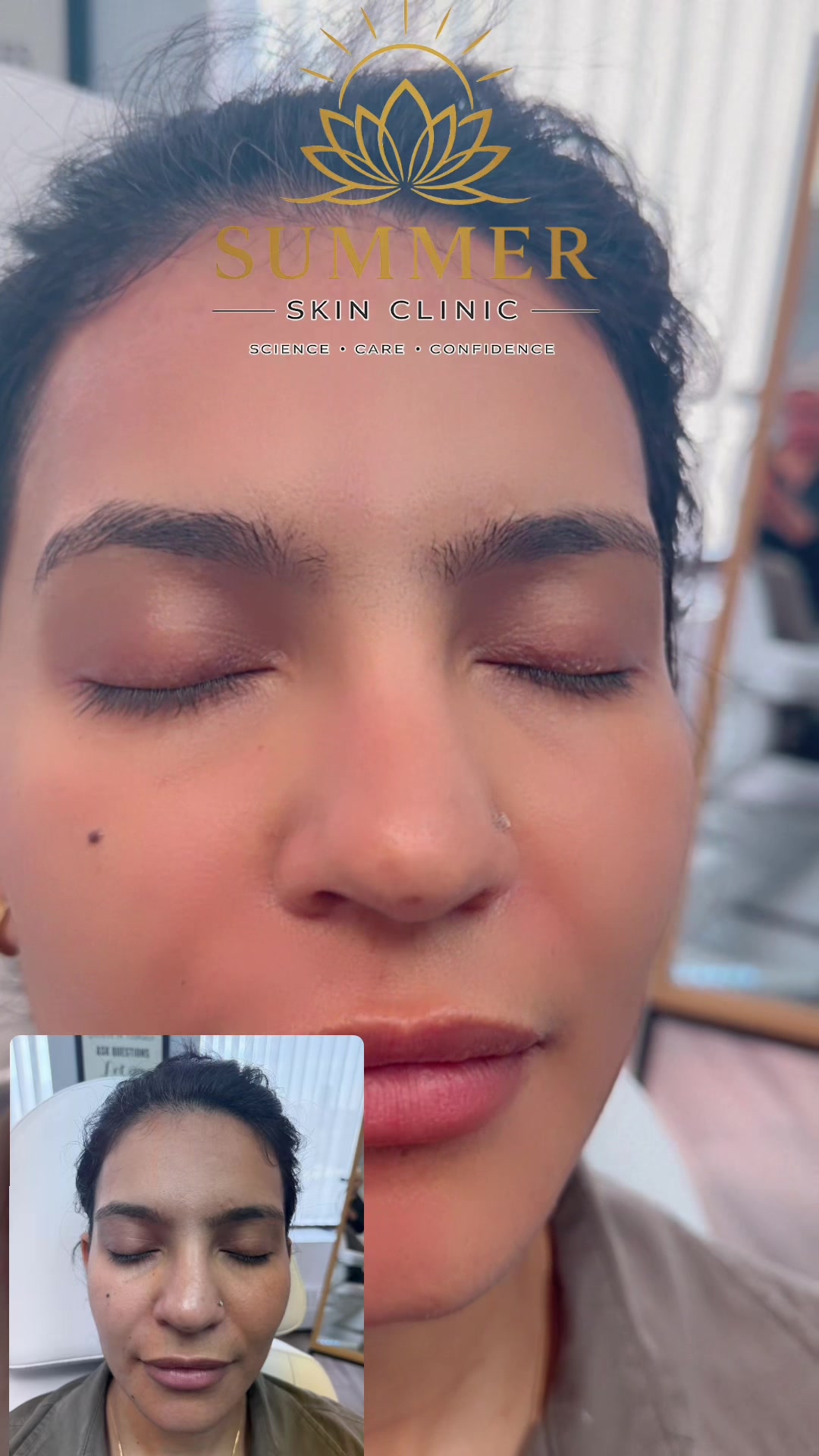 @Summer Skin Clinic | Toronto