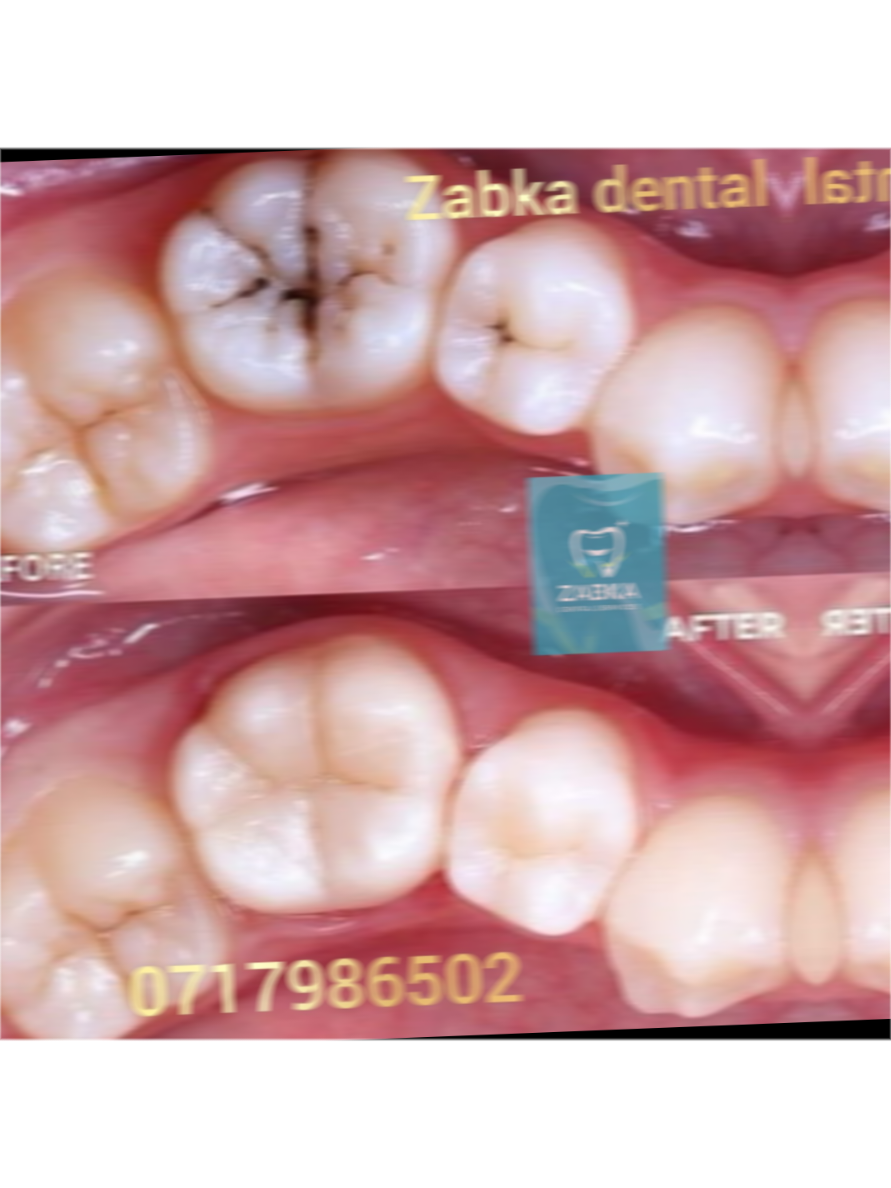 @Zabka Dental
