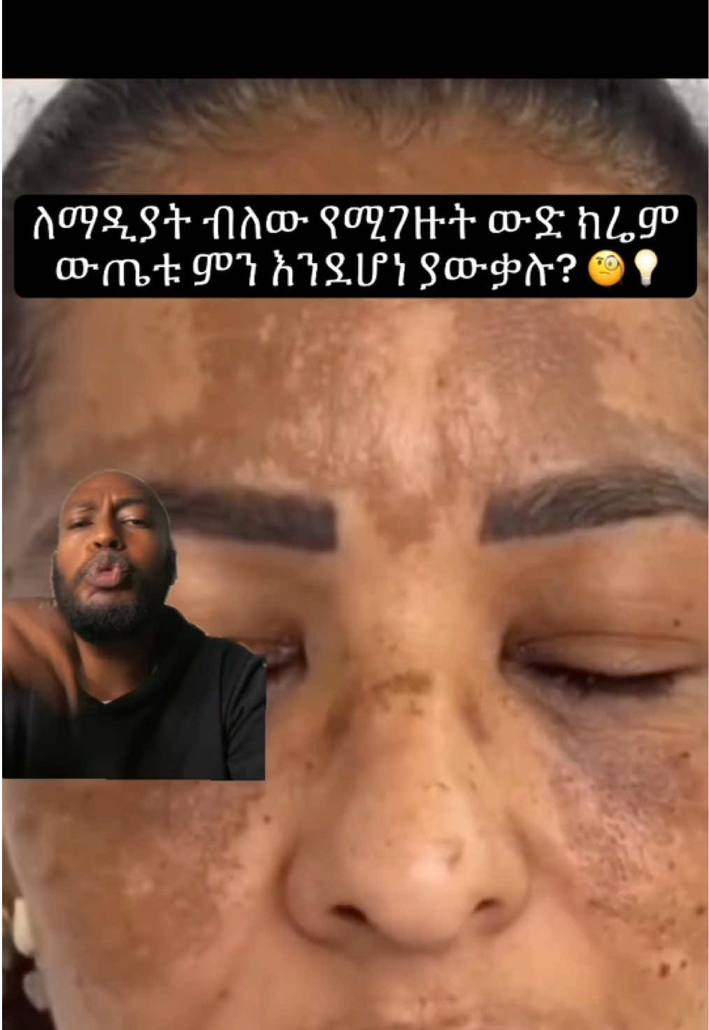 @KAY | ኬይ 🎙️