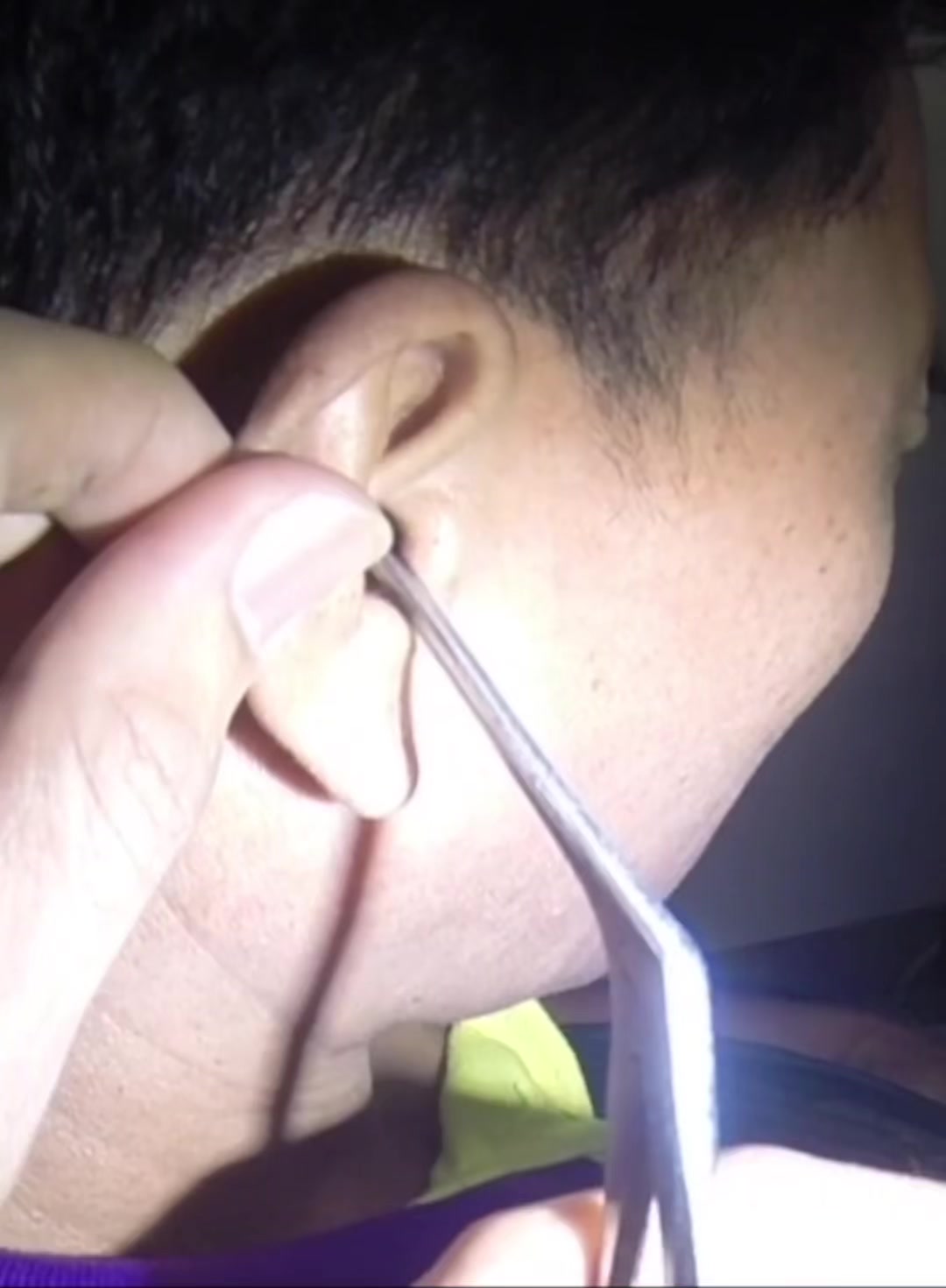 @TheEarwaxSpecialist