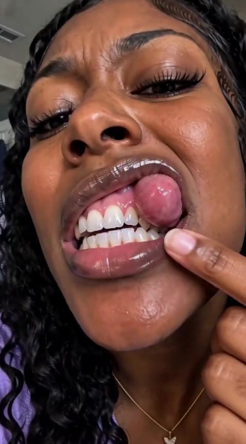 @uion9p5f