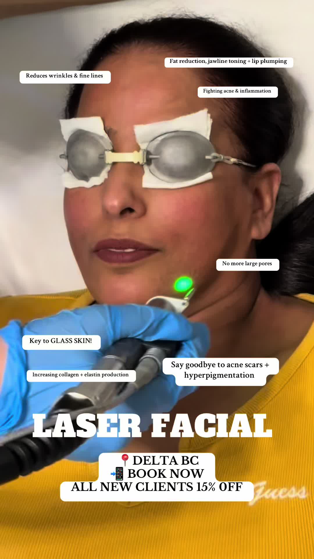 @Yris Skin Laser Boutique Delta