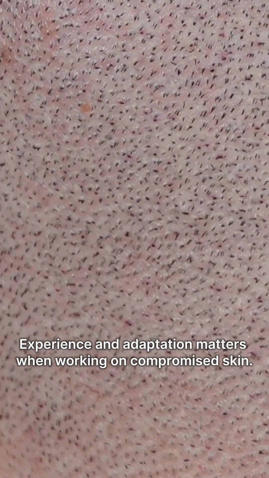 @Enhanced Scalp