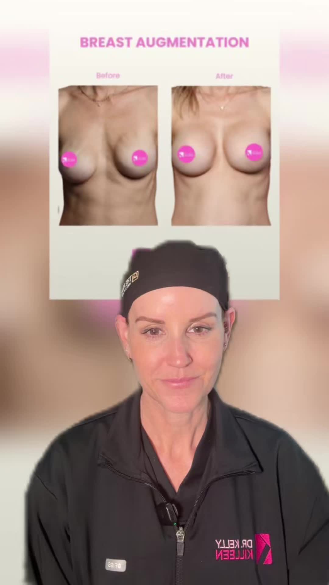 @Kelly Killeen, MD, FACS