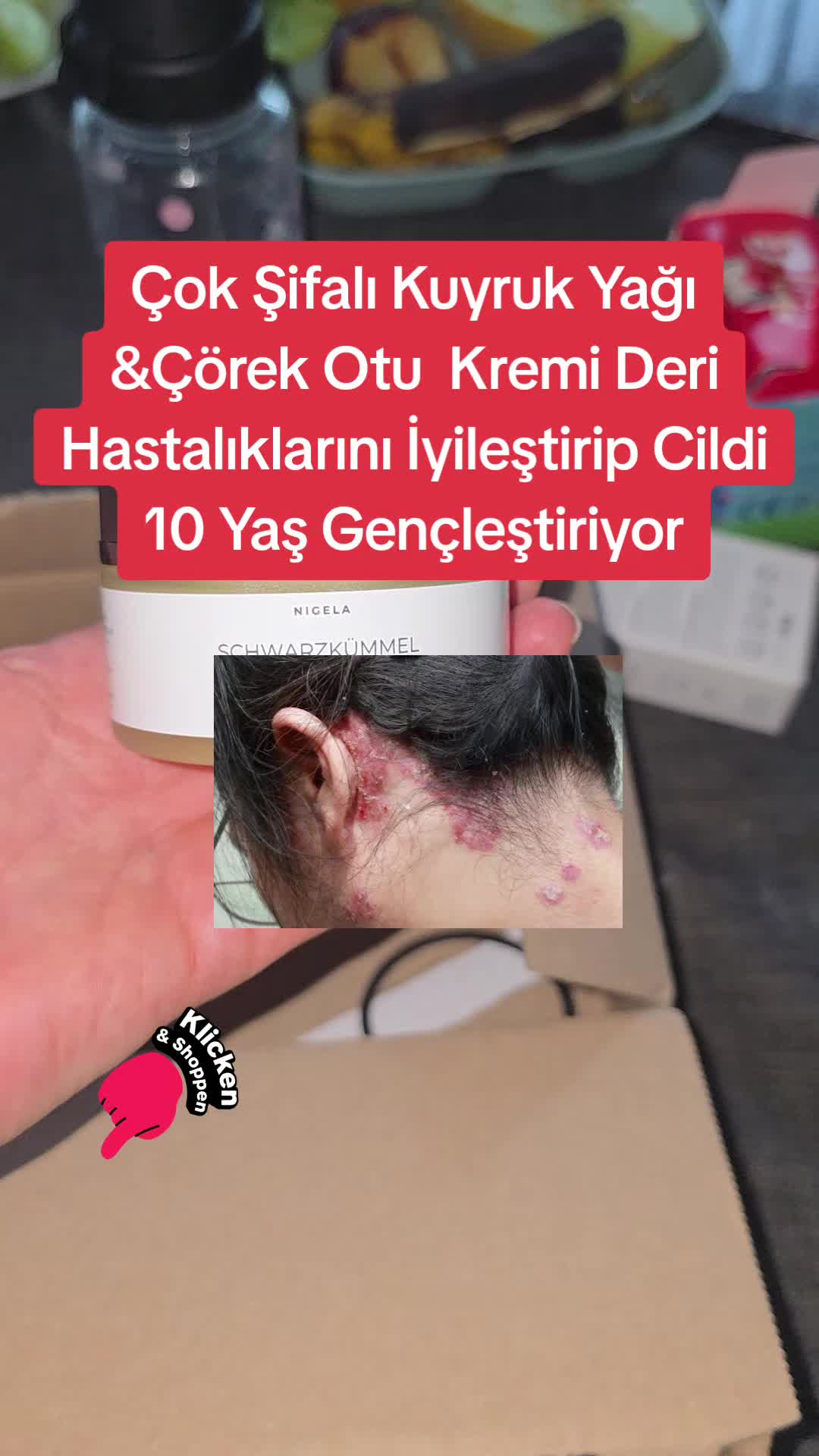 @Gurbetana27