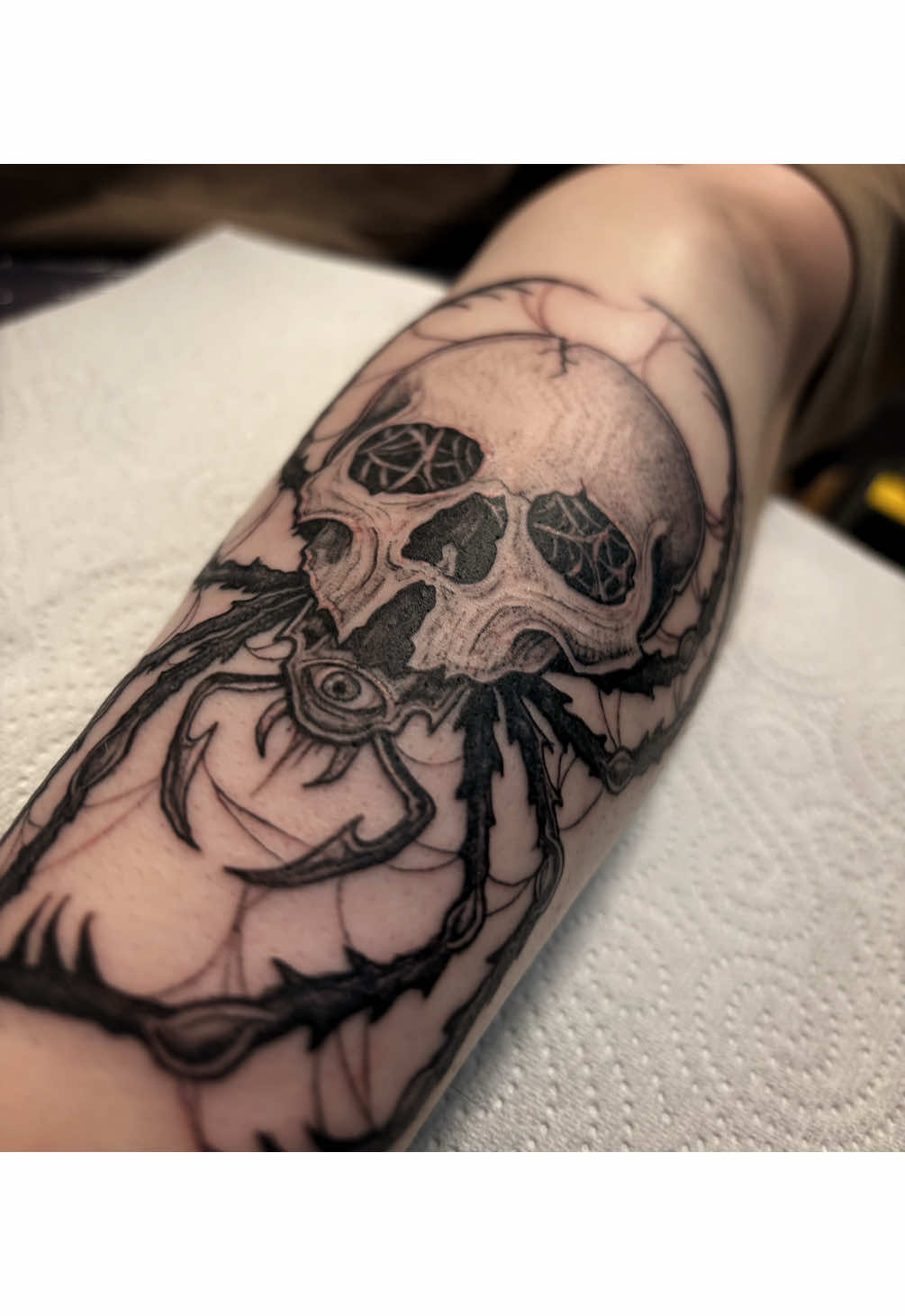 @Scorched_bones
