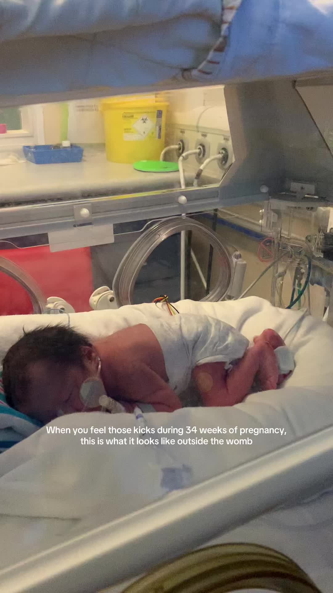 @zoeandherpreemies