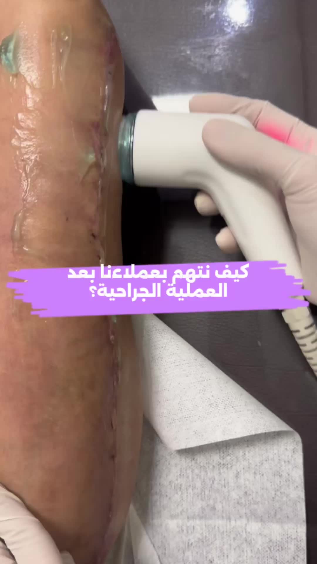 @لايف ستايل HBR 💚