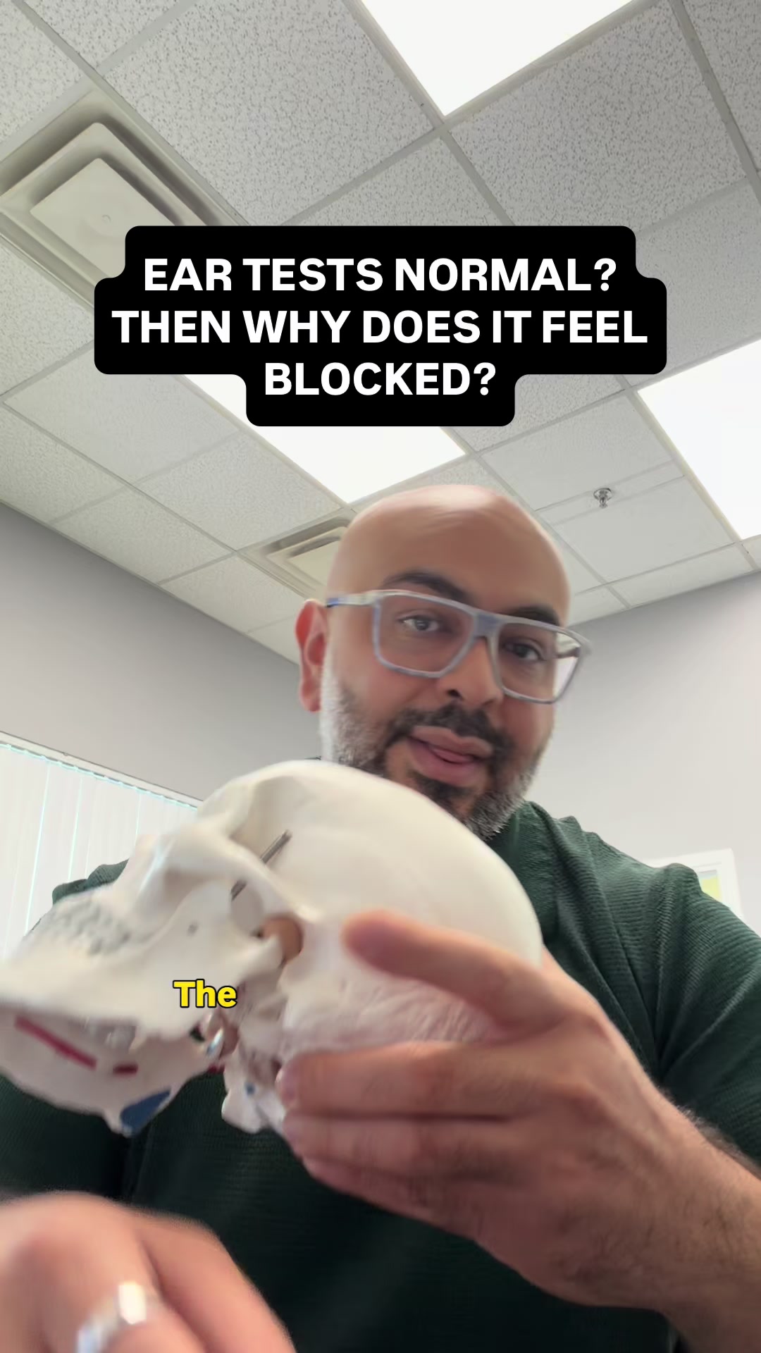 @Movability