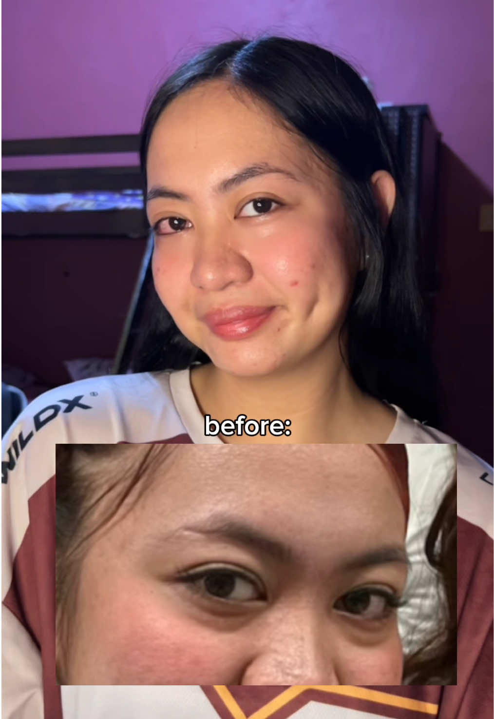 @Patricia