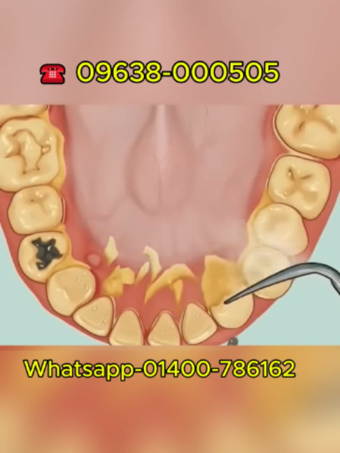 @Tech Dental