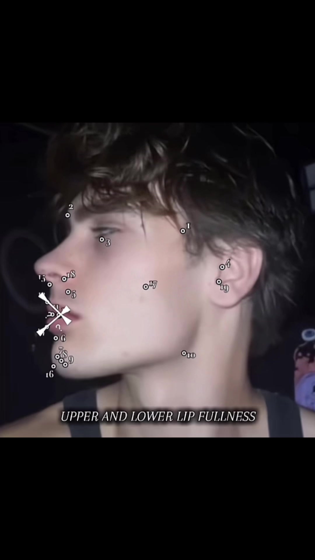 @pflg7