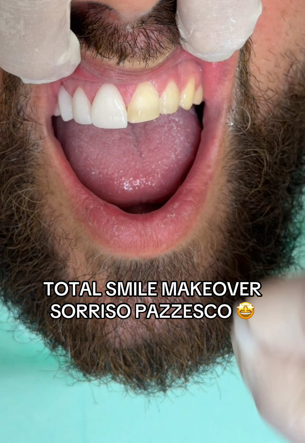 @Annalisa Longobardi