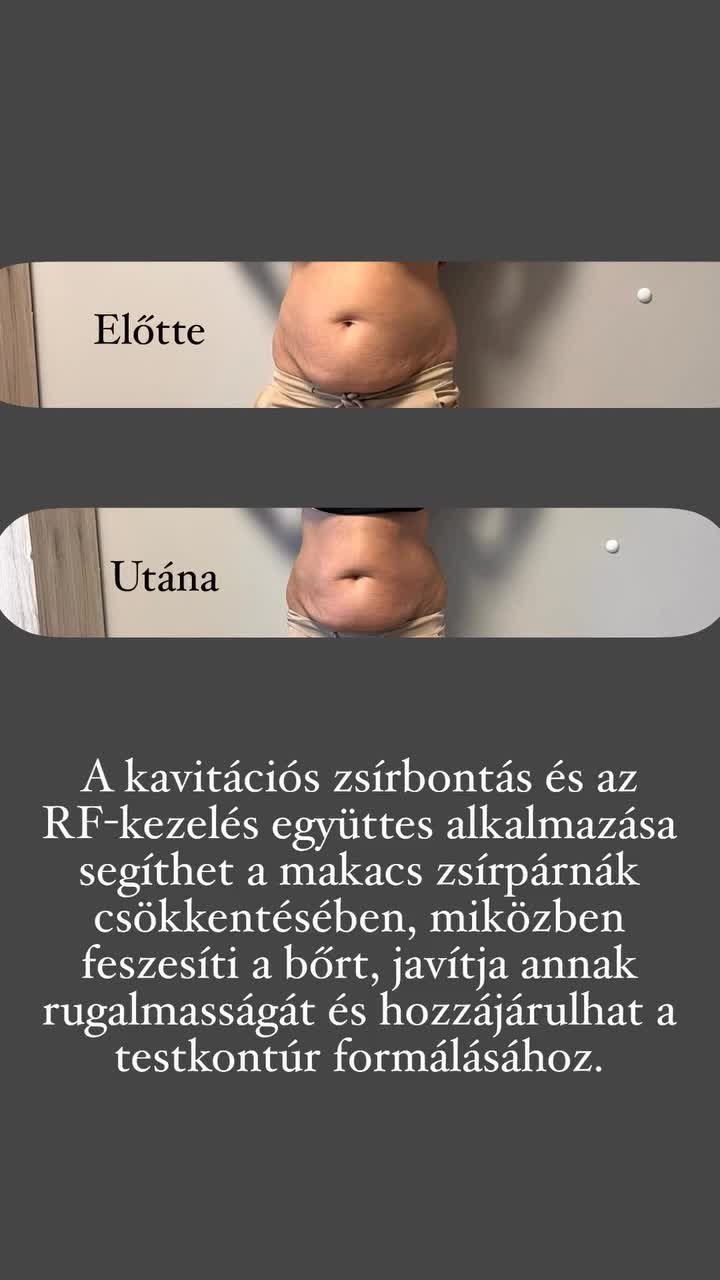 @EverSlim by Evelyn🌸