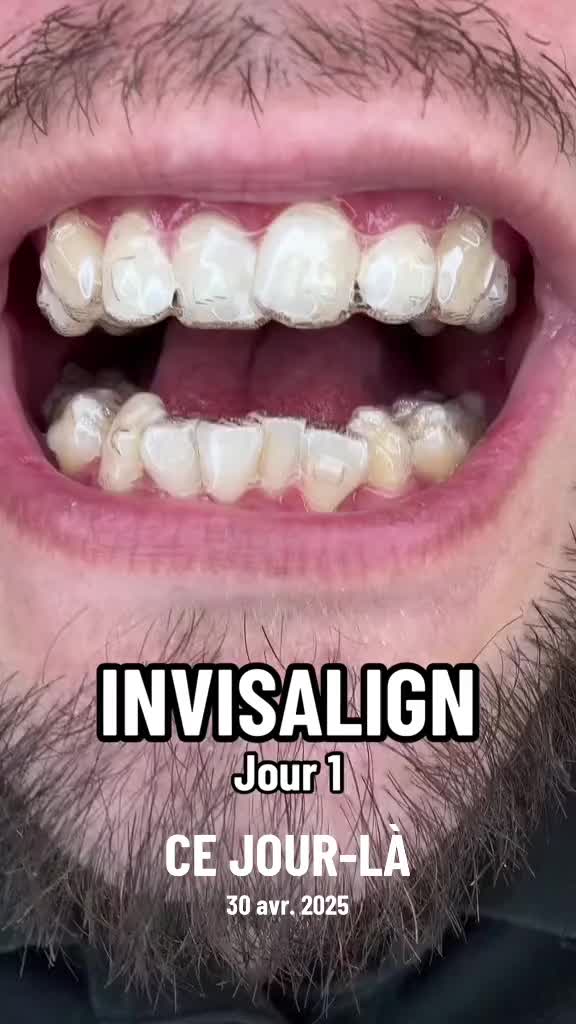 @Aymeric