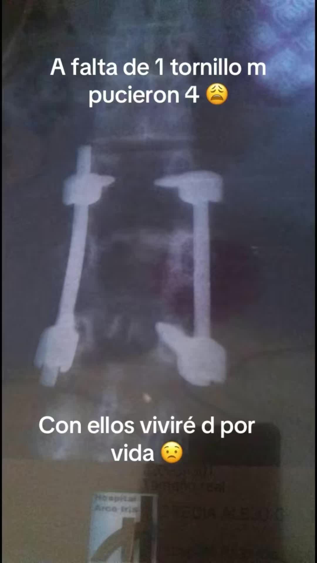 @blesomos3
