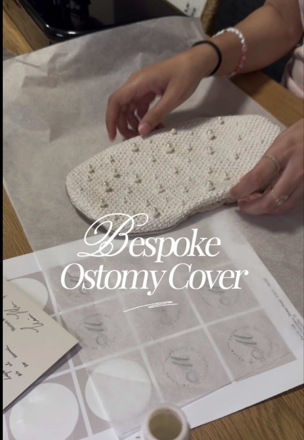 @ostomate