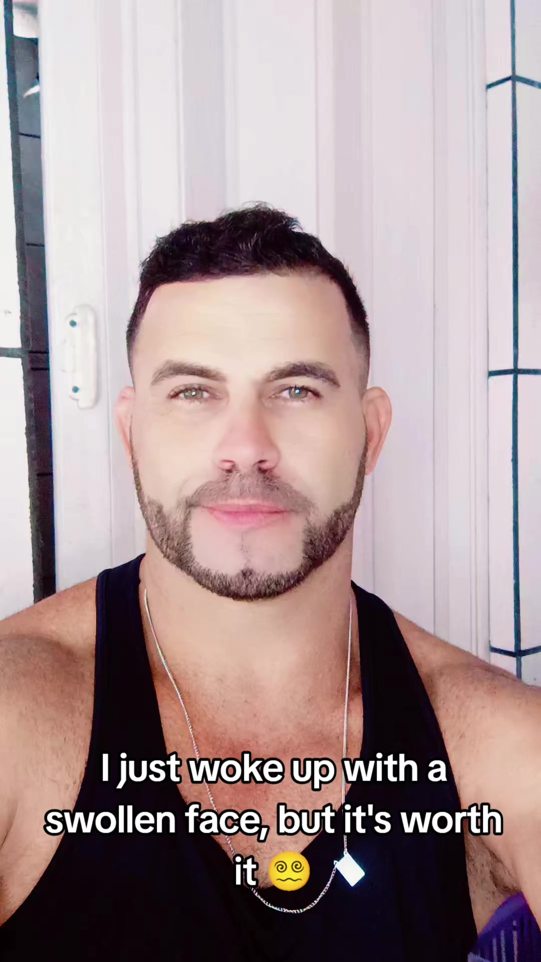 @olhos ๐๐de gato๐