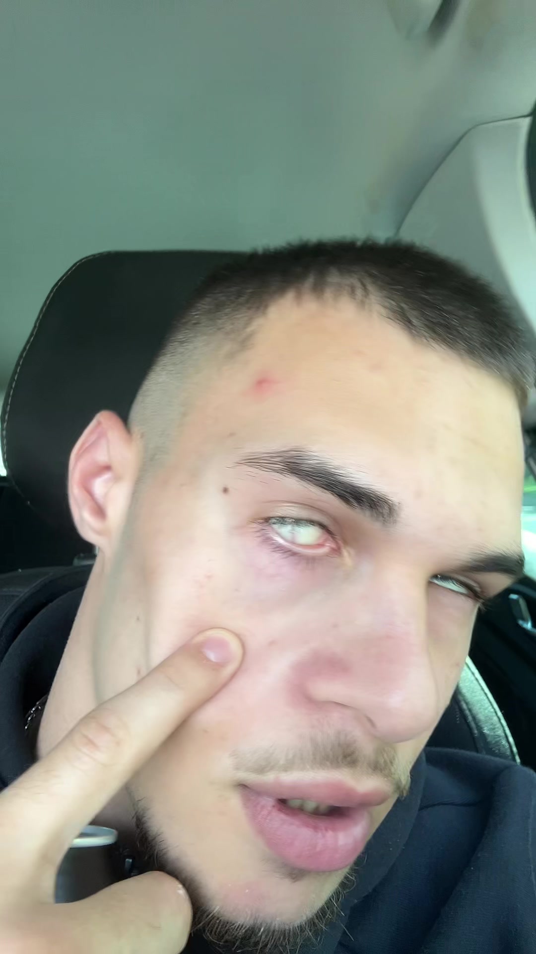 @noel187erz