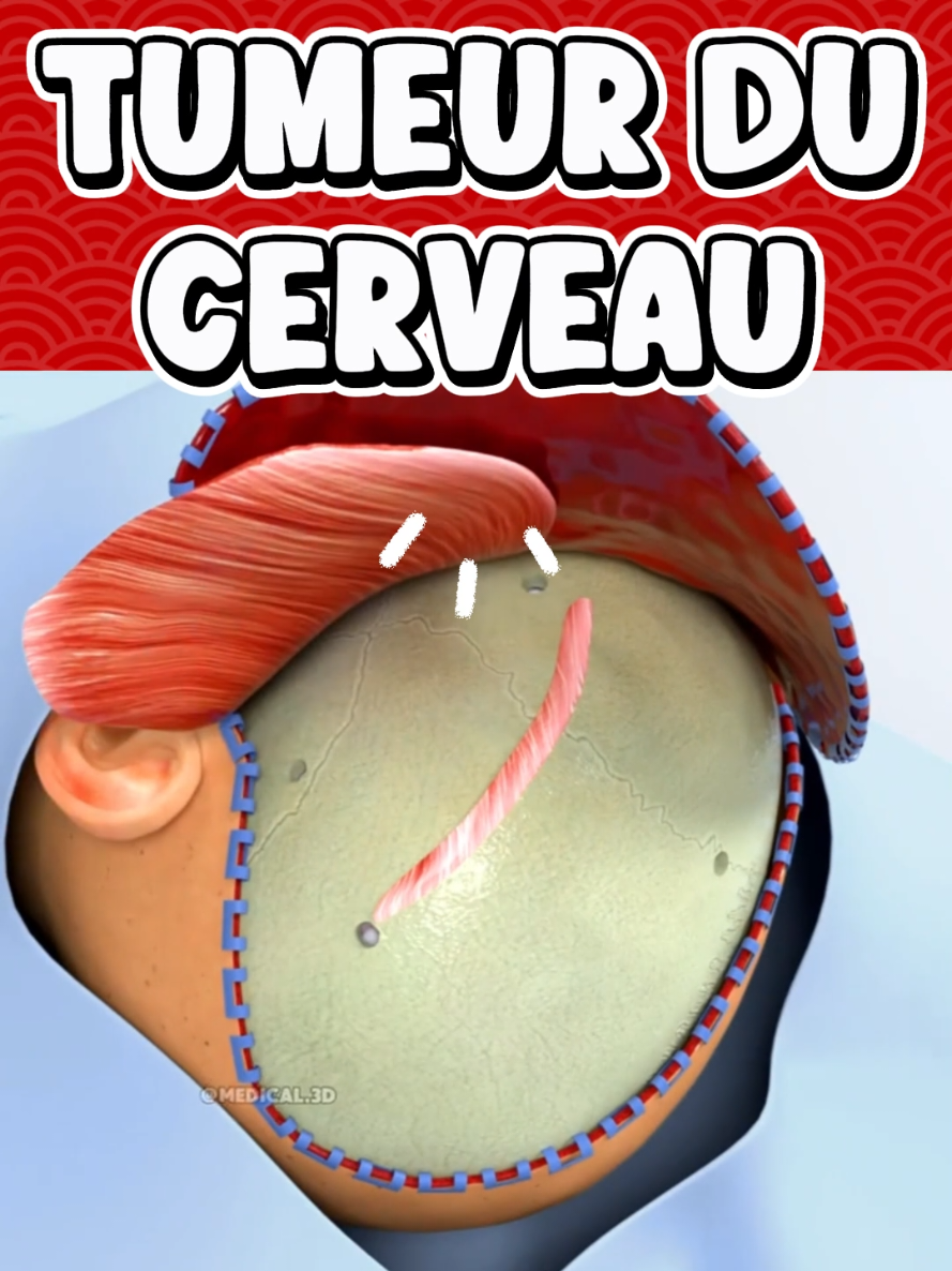 @Docteur Shepherd