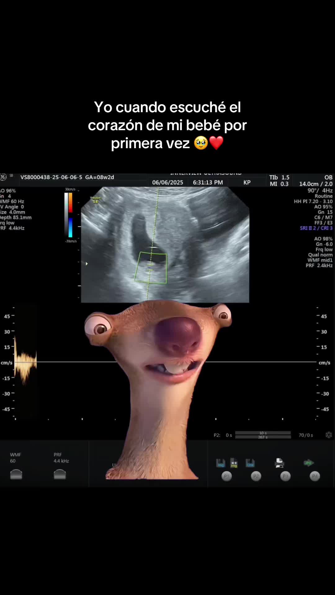 @Griselda Alvarez