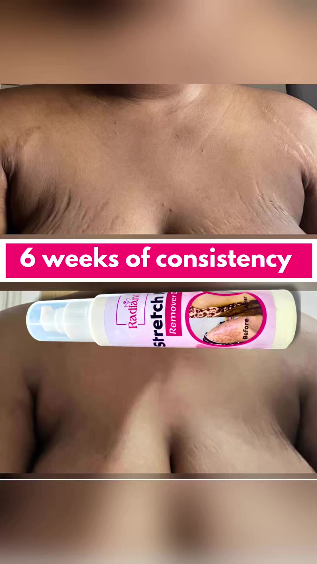 @Radiant skin